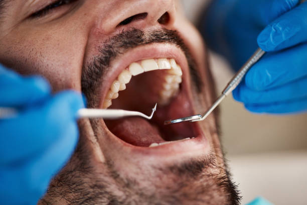 Best TMJ/TMD Treatment  in Canyon Lake, TX